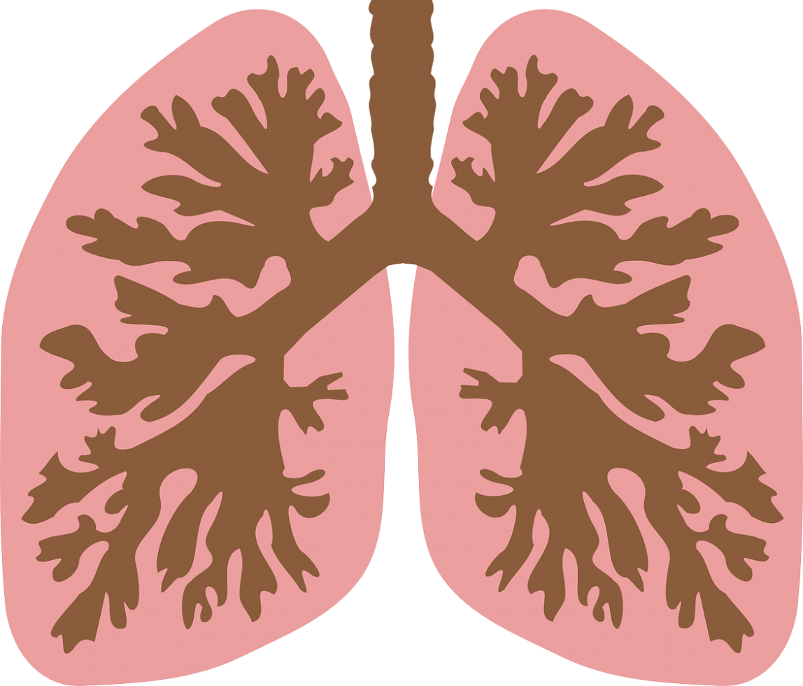 Derrame Pleural Qu Es S Ntomas Tratamiento Diagn Stico